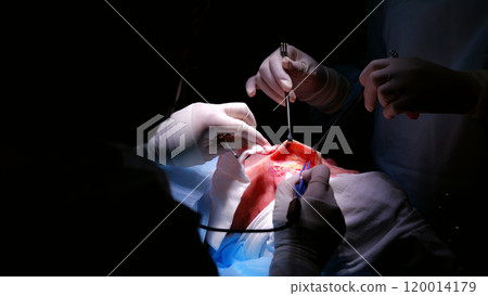 Surgeons in the operating room focus on delicate head surgery, wearing sterile gear and using precise instruments. Blood shows their skill and teamwork 120014179