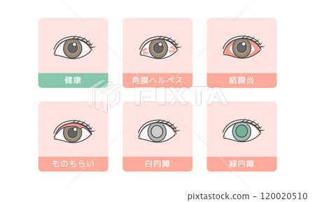 Eye disease illustration set 120020510