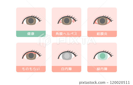 Eye disease illustration set Eye disease illustration set 120020511