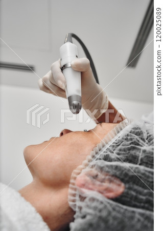 Aesthetic treatment session conducted with a microneedling device in a clinic 120025089