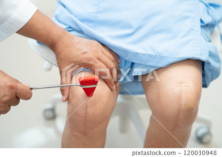 Asian doctor knock on knee reflex nerve for check and treatment senior patient in hospital. 120030948