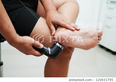 Asian woman use electric foot scrubber for treat and repair dry heel skin. 120031795