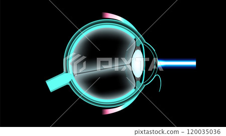 LASIK eye surgery 120035036