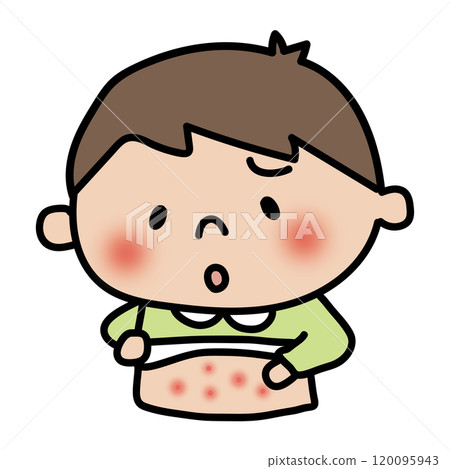 Boy with eczema on his body Boy with eczema on his body 120095943