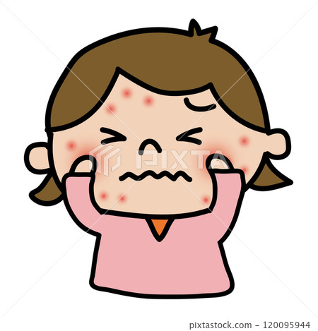 A girl with eczema on her face A girl with eczema on her face 120095944