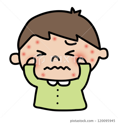 男孩臉上長濕疹很癢 120095945