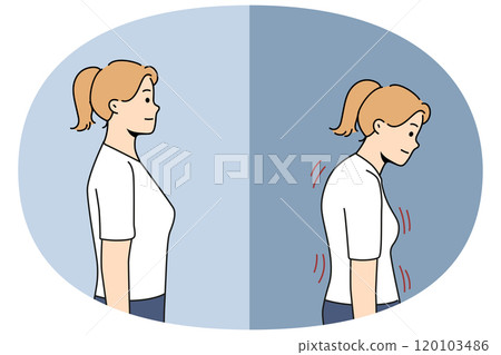 Stooped woman before and after correcting posture thanks to massage therapist or chiropractor Stooped woman before and after correcting posture thanks to massage therapist or chiropractor 120103486