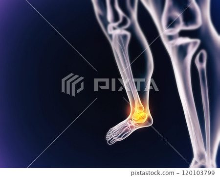 When inflammation strikes. A cgi view of an inflamed joint isolated on blue. 120103799