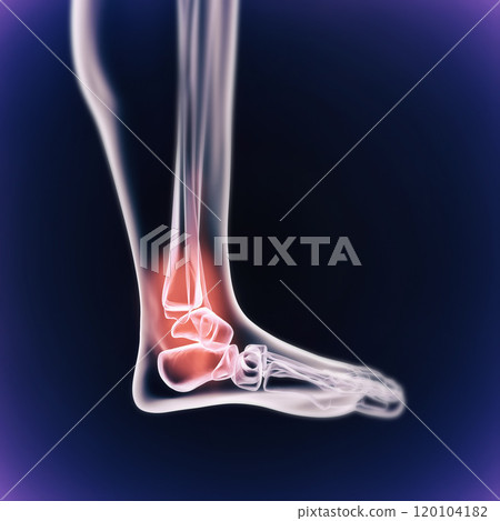 When inflammation strikes. A cgi view of an inflamed joint isolated on blue. 120104182