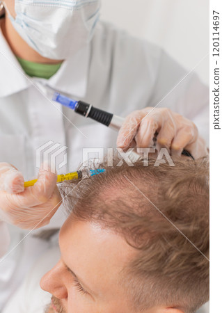 Trichologist doing man improve hair growth procedure, dermapen microneedling, vitamin injections 120114697