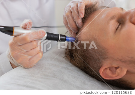 Trichologist doing man improve hair growth procedure, dermapen microneedling, vitamin injections 120115688