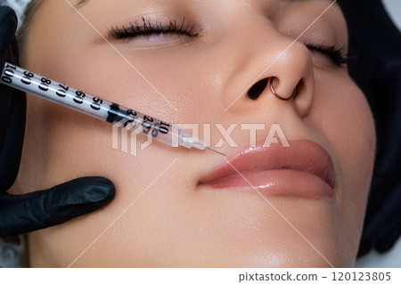 A beautician performs a lip augmentation procedure with hyaluronic acid. The process of injecting filler into the lips. A beautician performs a lip augmentation procedure with hyaluronic acid. The process of injecting filler into the lips. 120123805