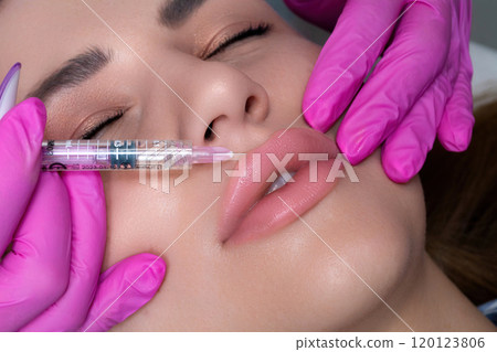 A beautician performs a lip augmentation procedure with hyaluronic acid. The process of injecting filler into the lips. A beautician performs a lip augmentation procedure with hyaluronic acid. The process of injecting filler into the lips. 120123806