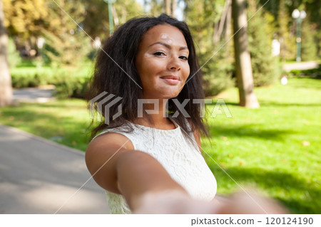 Smiling woman with vitiligo skin problem taking Smiling woman with vitiligo skin problem taking 120124190