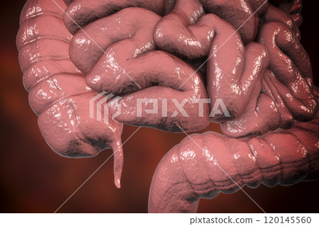 Human colon with appendix 120145560