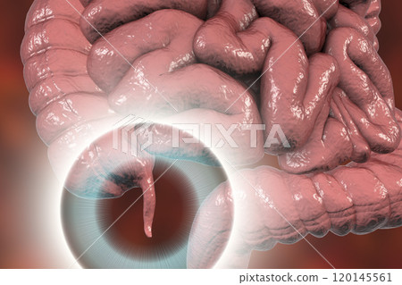 Human colon with appendix Human colon with appendix 120145561