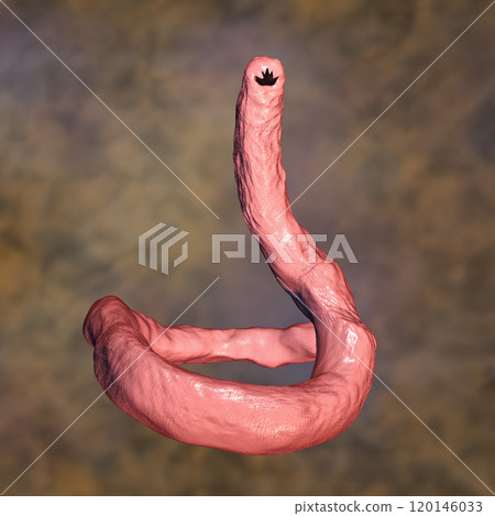 Parasitic hookworm Ancylosoma 120146033