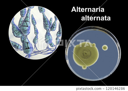 Mold Alternaria alternata, illustration and photo of colony on nutrient medium Mold Alternaria alternata, illustration and photo of colony on nutrient medium 120146286