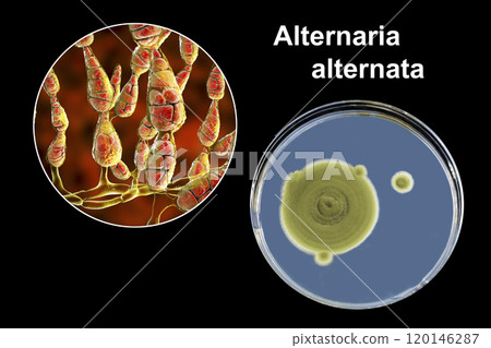 Mold Alternaria alternata, illustration and photo of colony on nutrient medium Mold Alternaria alternata, illustration and photo of colony on nutrient medium 120146287