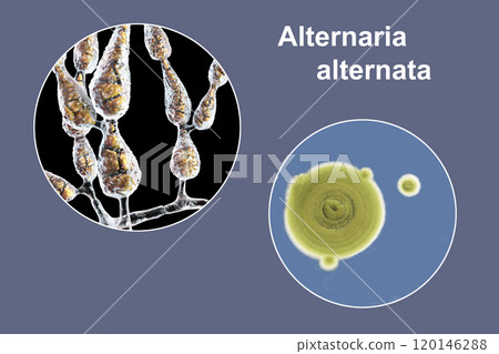 Mold Alternaria alternata, illustration and photo of colony on nutrient medium Mold Alternaria alternata, illustration and photo of colony on nutrient medium 120146288