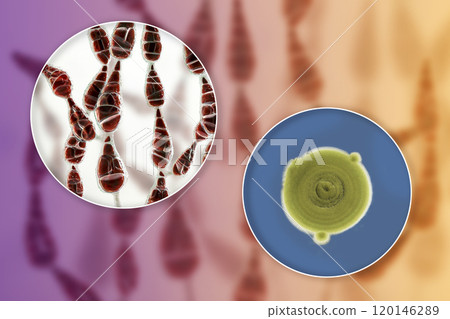 Mold Alternaria alternata, illustration and photo of colony on nutrient medium Mold Alternaria alternata, illustration and photo of colony on nutrient medium 120146289