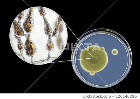 Mold Alternaria alternata, illustration and photo of colony on nutrient medium Mold Alternaria alternata, illustration and photo of colony on nutrient medium 120146290