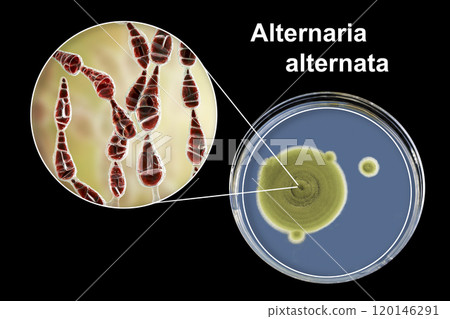 Mold Alternaria alternata, illustration and photo of colony on nutrient medium 120146291