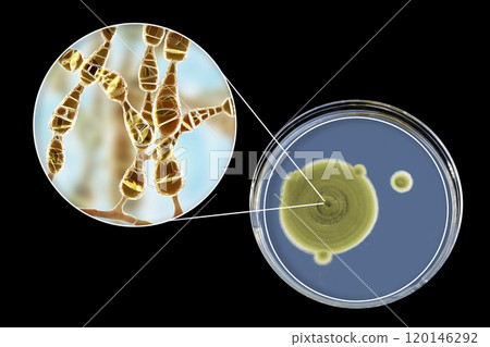 Mold Alternaria alternata, illustration and photo of colony on nutrient medium 120146292