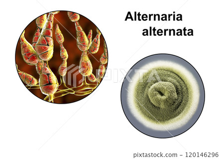 Mold Alternaria alternata, illustration and photo of colony on nutrient medium Mold Alternaria alternata, illustration and photo of colony on nutrient medium 120146296