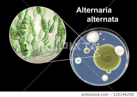 Mold Alternaria alternata, illustration and photo of colony on nutrient medium 120146298