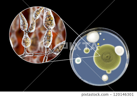Mold Alternaria alternata, illustration and photo of colony on nutrient medium 120146301