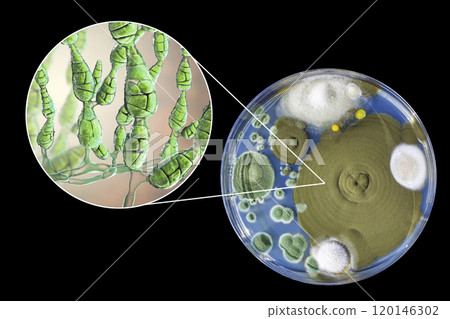 Mold Alternaria alternata, illustration and photo of colony on nutrient medium 120146302