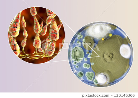 Mold Alternaria alternata, illustration and photo of colony on nutrient medium Mold Alternaria alternata, illustration and photo of colony on nutrient medium 120146306