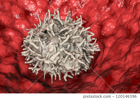 Alveolar macrophage, or dust cell Alveolar macrophage, or dust cell 120146396