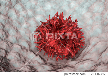 Alveolar macrophage, or dust cell Alveolar macrophage, or dust cell 120146397