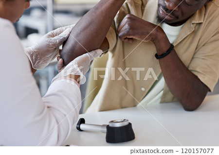 Close up of unrecognizable doctor examining arms of patient during consultation in clinic copy space 120157077