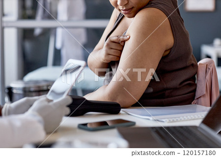 Close up of unrecognizable African American woman pointing at skin rash on shoulder and explaining symptoms while consulting with dermatologist in clinic copy space Close up of unrecognizable African American woman pointing at skin rash on shoulder and explaining symptoms while consulting with dermatologist in clinic copy space 120157180