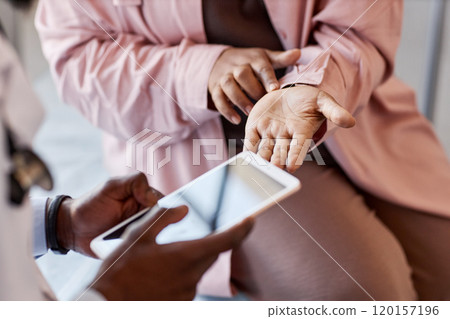 Close up of unrecognizable African American woman pointing at skin rash on hands while talking to doctor holding tablet in clinic copy space 120157196