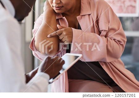 Close up of adult African American woman visiting dermatologist and pointing at skin rash on elbow during consultation copy space 120157201