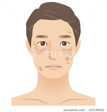 中年男人,污漬,美容,衰老 中年男人,污漬,美容,衰老 120196902