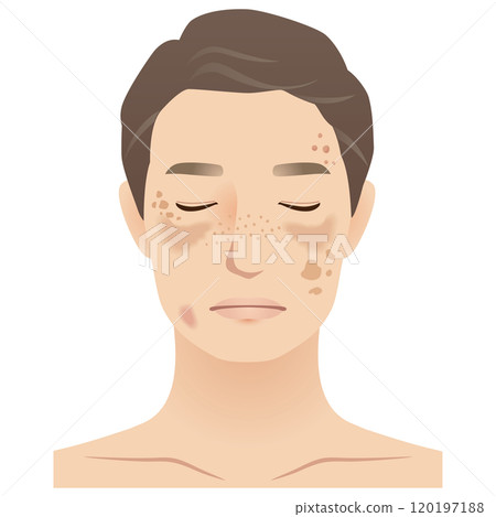 中年男人,污漬,美容,衰老 中年男人,污漬,美容,衰老 120197188