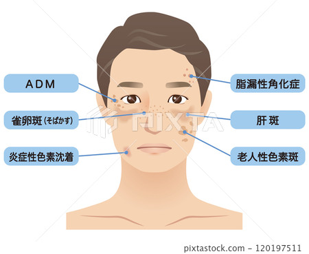 Middle-aged men, age spots, name, beauty, aging 120197511