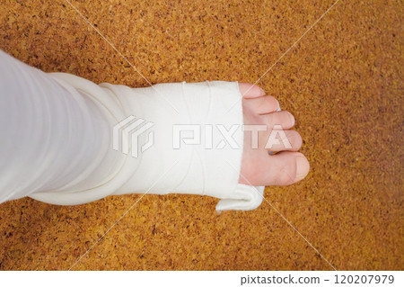A man in his 50s falls from the second floor of an apartment building, breaks his ankle and heel, and is now in a cast for the third day. 120207979