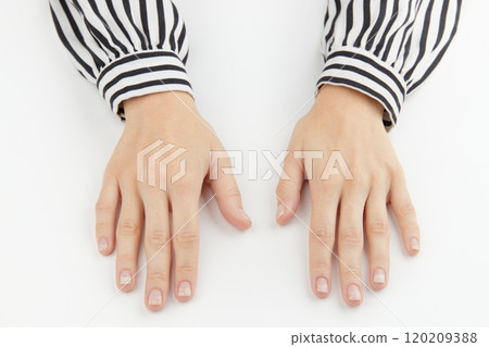 Fingernails with onycholysis after removing gel polish on white background. Womans hands with damaged nails 120209388