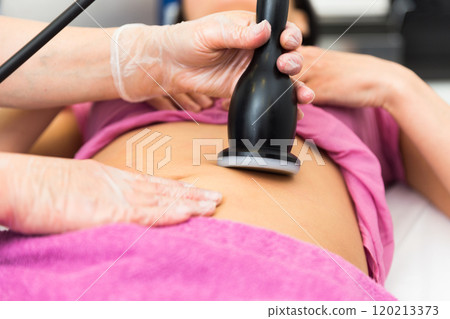 Closeup of hardware procedure of rf skin lifting on female belly 120213373