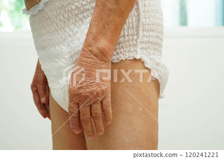 Asian senior woman patient wearing adult incontinence diaper pad in hospital. 120241221