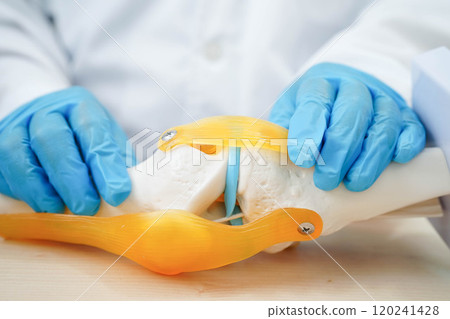 Knee osteoarthritis, Doctor showing model knee joint orthopedic. Knee osteoarthritis, Doctor showing model knee joint orthopedic. 120241428