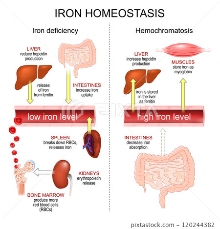 Iron Homeostasis. Hemochromatosis and Iron deficiency anemia. 120244382