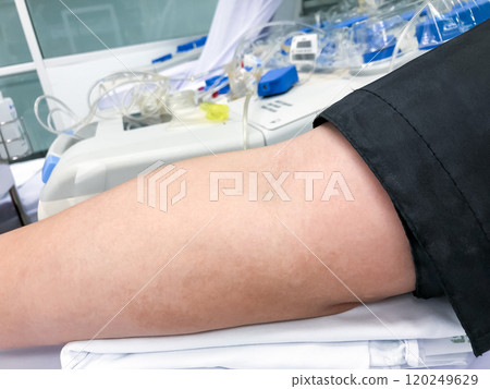 Blood platelet donation, a male nurse inserts a needle into donor arm to draw blood at a hospital. Blood platelet donation, a male nurse inserts a needle into donor arm to draw blood at a hospital. 120249629