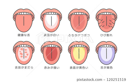 舌頭健康狀態類型插圖集（附說明） 120251519